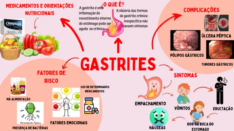 GASTRITE