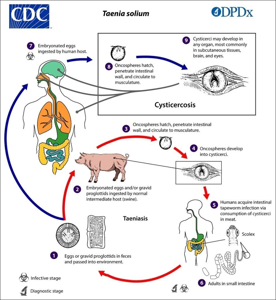 Mapa mental com CDC no centro, ramificando-se para Taenia solium e DPDx