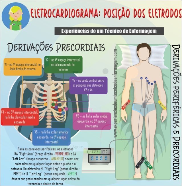 Mapa mental com ELETROCARDIOGRAMA POSIÇÃO DOS ELETRODOS no centro, ramificando-se para Experiências de um Técnico de Enfermagem e DERIVAÇÕES PRECORDIAIS