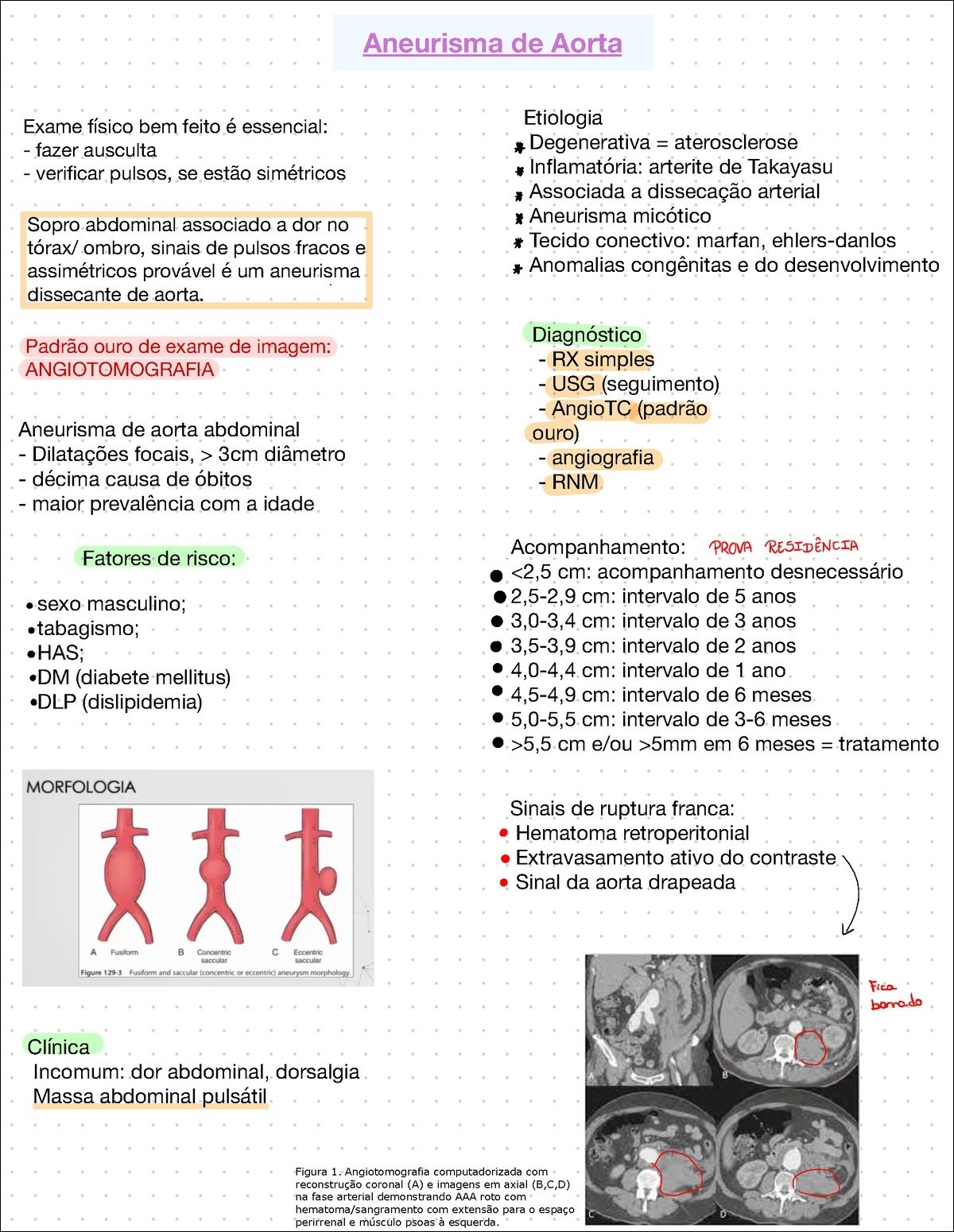 Mapa mental com Aneurisma de Aorta no centro, ramificando-se para Etiologia e Exame físico bem feito é essencial