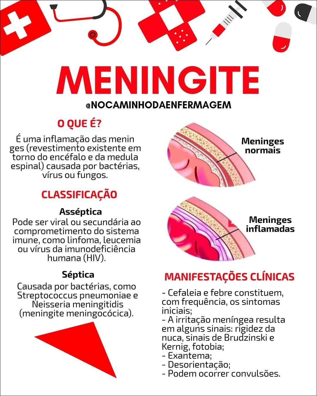 Mapas Mentais Sobre MENINGITE - Study Maps