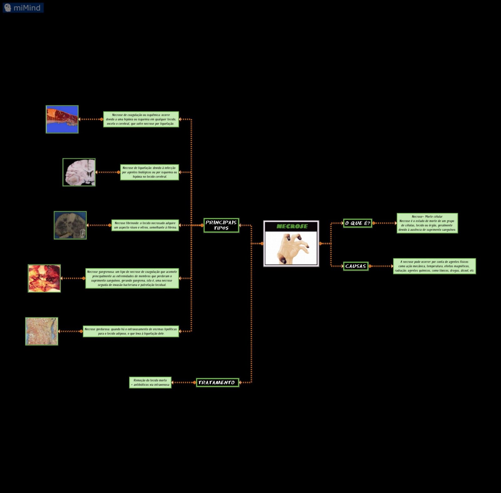 Necrose: Tipos, Causas e Características