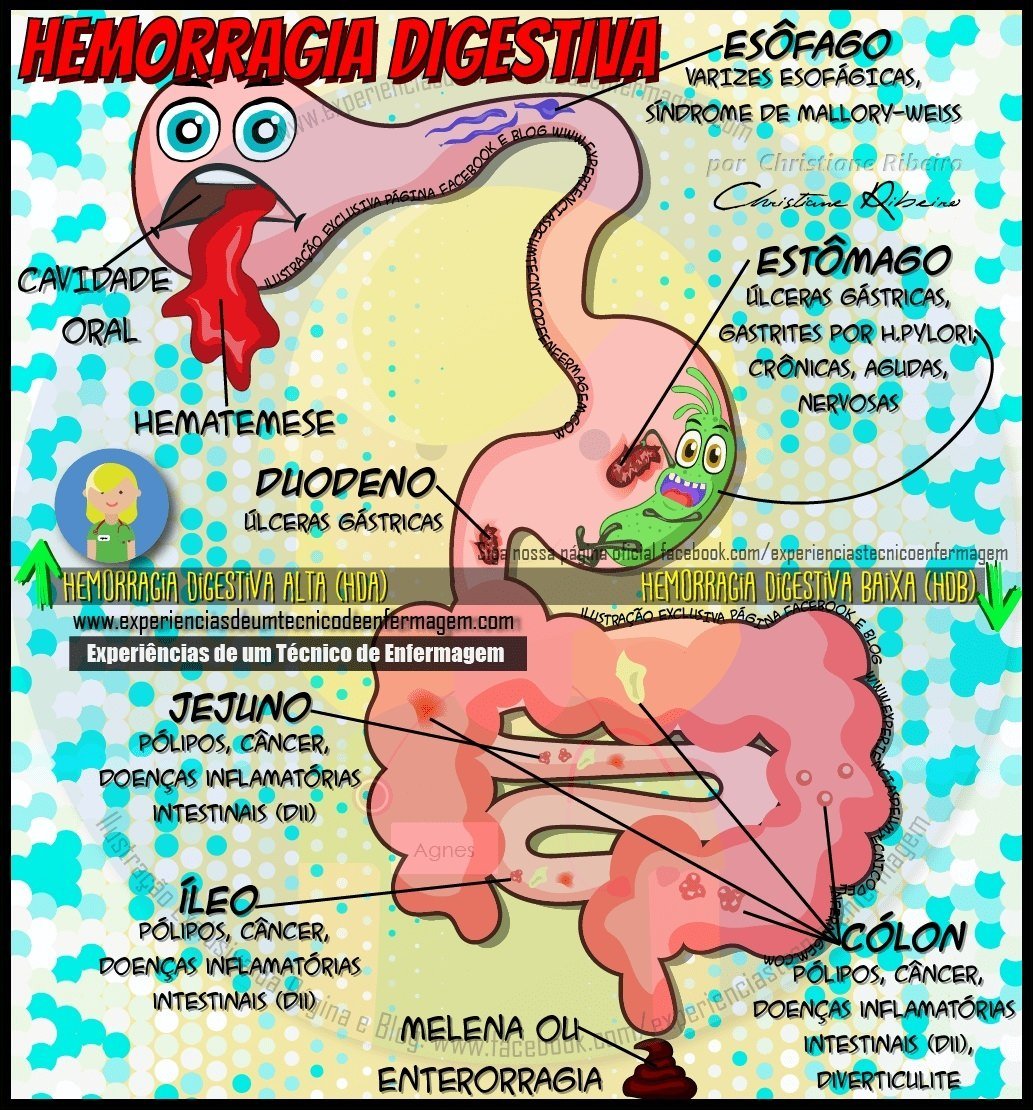 Mapa mental com Hemorragia Digestiva no centro, ramificando-se para Esôfago e Varizes Esofágicas